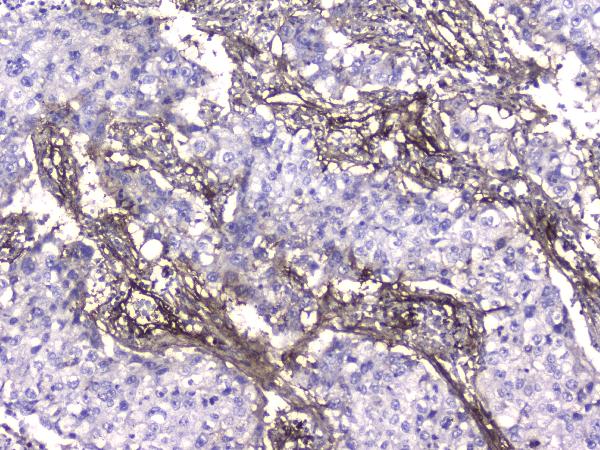 2 - Anti-Collagen IV COL4A1 Antibody Picoband™ (monoclonal, 3G3) ABO14330