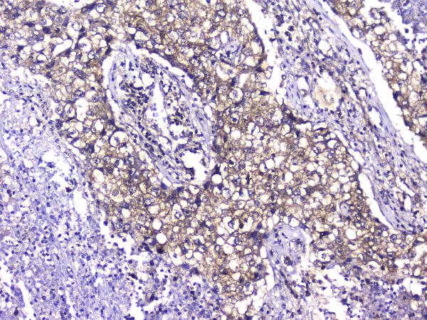2 - Anti-TCP1 alpha Antibody Picoband™ (monoclonal, 2E7) ABO14331