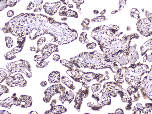 2 - Anti-TCP1 alpha Antibody Picoband™ (monoclonal, 2E7) ABO14331