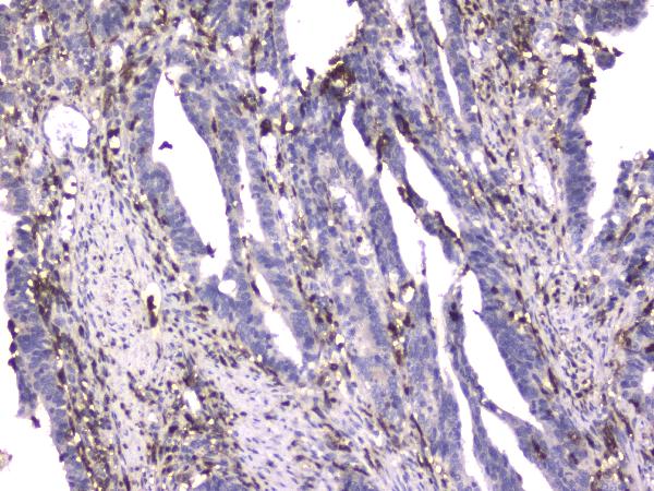 2 - Anti-CD18 ITGB2 Antibody Picoband™ (monoclonal, 1A3/2A10) ABO14332