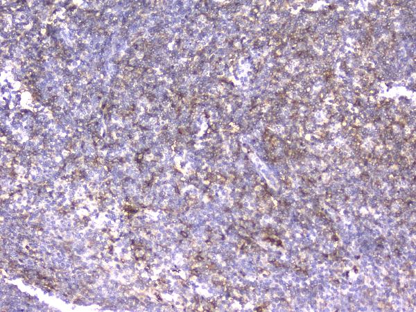 2 - Anti-CD18 ITGB2 Antibody Picoband™ (monoclonal, 1A3/2A10) ABO14332