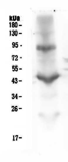 1 - Anti-CD18 ITGB2 Antibody Picoband™ (monoclonal, 1A3/2A10) ABO14332