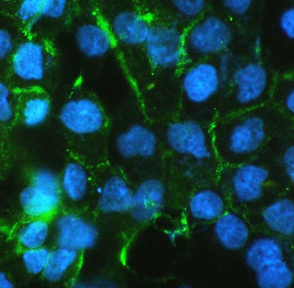 3 - Anti-beta Catenin CTNNB1 Antibody Picoband™ (monoclonal, 1F6) ABO14333