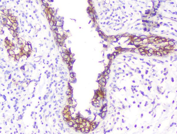 2 - Anti-beta Catenin CTNNB1 Antibody Picoband™ (monoclonal, 1F6) ABO14333