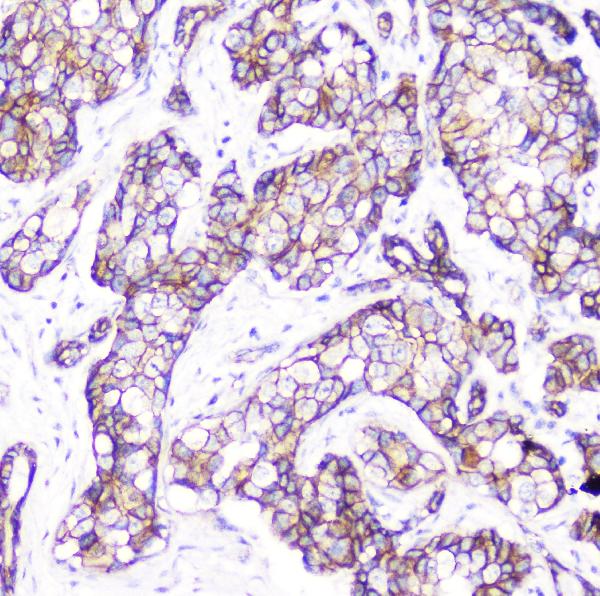 2 - Anti-beta Catenin CTNNB1 Antibody Picoband™ (monoclonal, 1F6) ABO14333