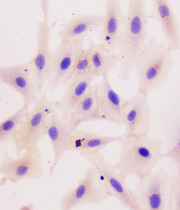 2 - Anti-beta Catenin CTNNB1 Antibody Picoband™ (monoclonal, 1F6) ABO14333