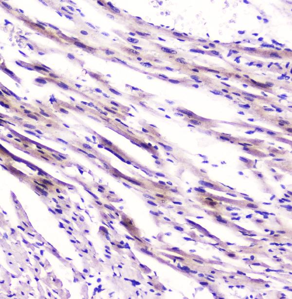 2 - Anti-Cardiac FABP Fabp3 Antibody Picoband™ (monoclonal, 6C4) ABO14334