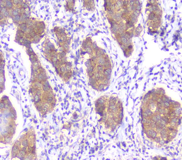 2 - Anti-SMN1/2 Antibody Picoband™ (monoclonal, 2B10) ABO14335