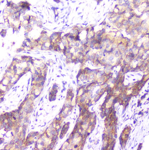 2 - Anti-SMN1/2 Antibody Picoband™ (monoclonal, 2B10) ABO14335