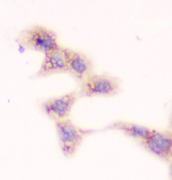 2 - Anti-SMN1/2 Antibody Picoband™ (monoclonal, 2B10) ABO14335