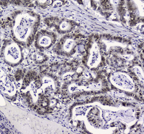 2 - Anti-APE1 APEX1 Antibody Picoband™ (monoclonal, 5C11) ABO14336