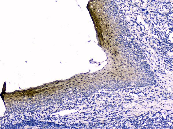 2 - Anti-Stefin B CSTB Antibody Picoband™ (monoclonal, 2B6) ABO14337