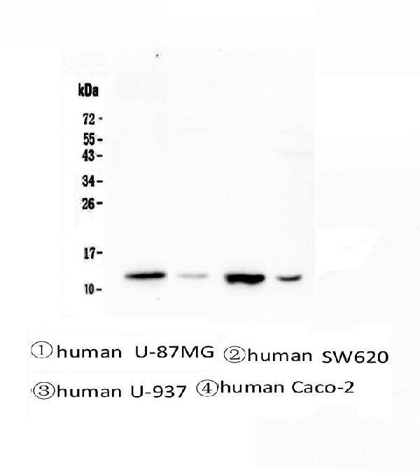 1 - Anti-Stefin B CSTB Antibody Picoband™ (monoclonal, 2B6) ABO14337