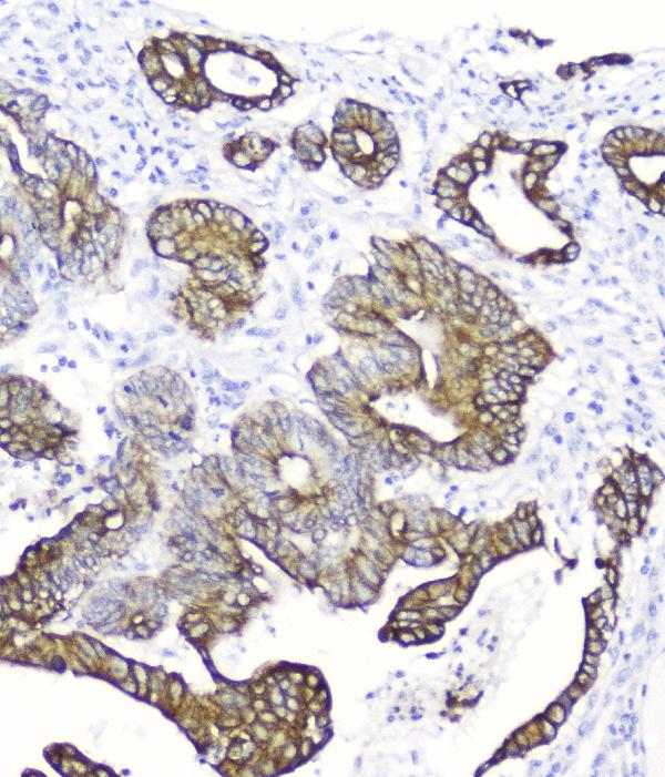 2 - Anti-Cytokeratin 19 KRT19 Antibody Picoband™ (monoclonal, 3D4) ABO14338