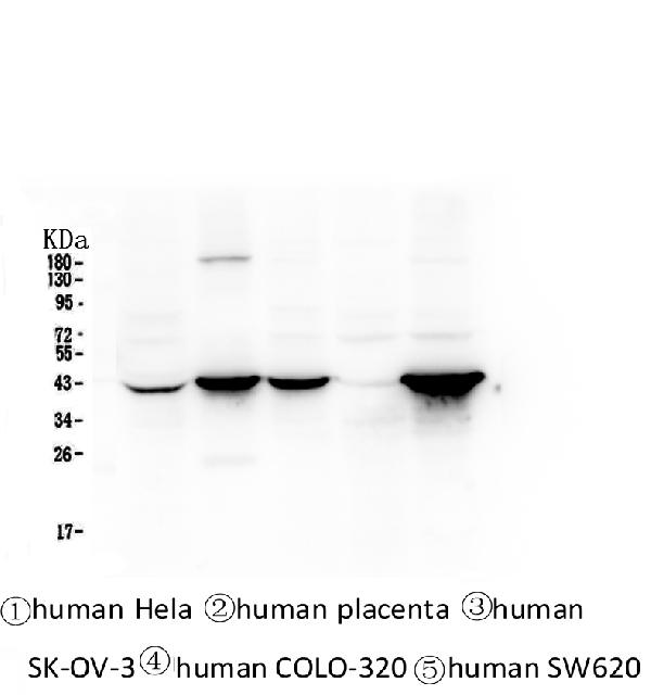 1 - Anti-Cytokeratin 19 KRT19 Antibody Picoband™ (monoclonal, 3D4) ABO14338