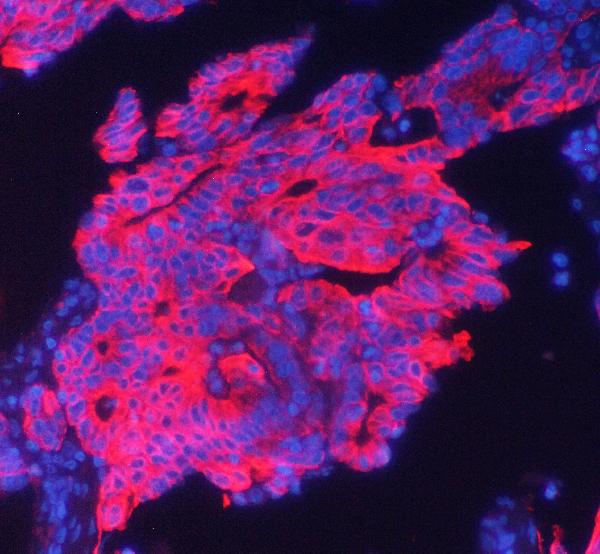 3 - Anti-Cytokeratin 19 KRT19 Antibody Picoband™ (monoclonal, 3D4) ABO14338