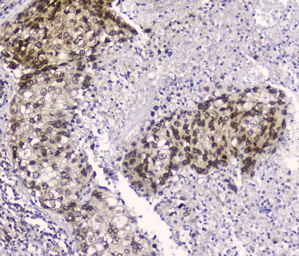 2 - Anti-CRM1 XPO1 Antibody Picoband™ (monoclonal, 5G3) ABO14339
