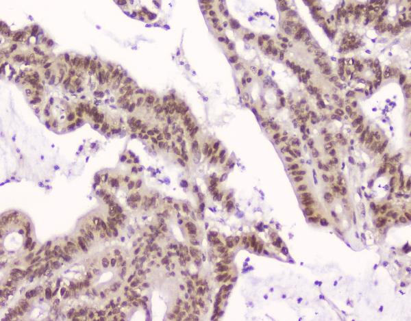 2 - Anti-CRM1 XPO1 Antibody Picoband™ (monoclonal, 5G3) ABO14339