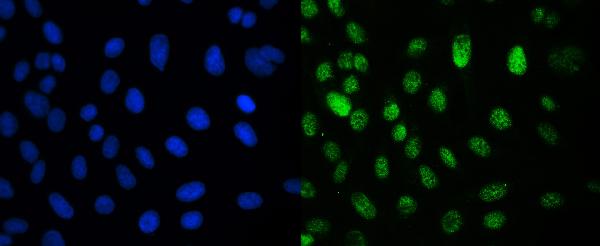 3 - Anti-CRM1 XPO1 Antibody Picoband™ (monoclonal, 5G3) ABO14339