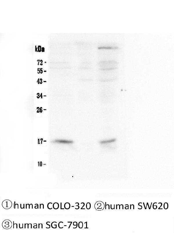 1 - Anti-FHIT Antibody Picoband™ (monoclonal, 26H7) ABO14340