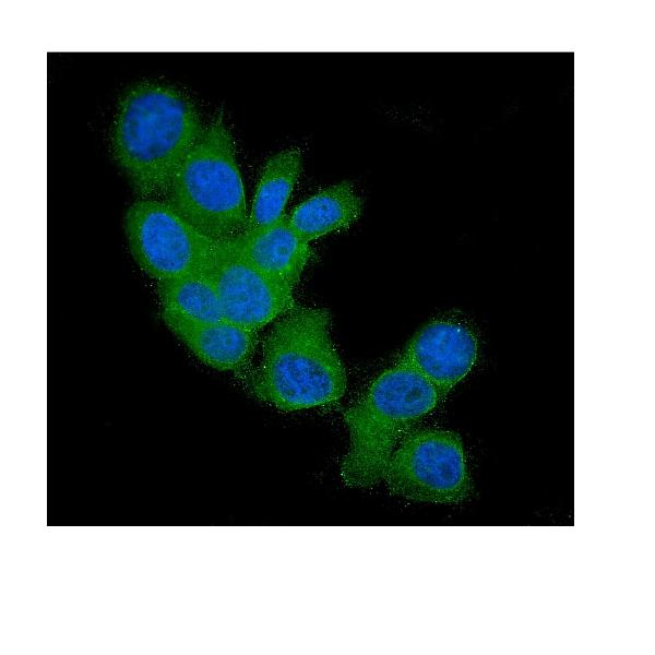 3 - Anti-FHIT Antibody Picoband™ (monoclonal, 26H7) ABO14340