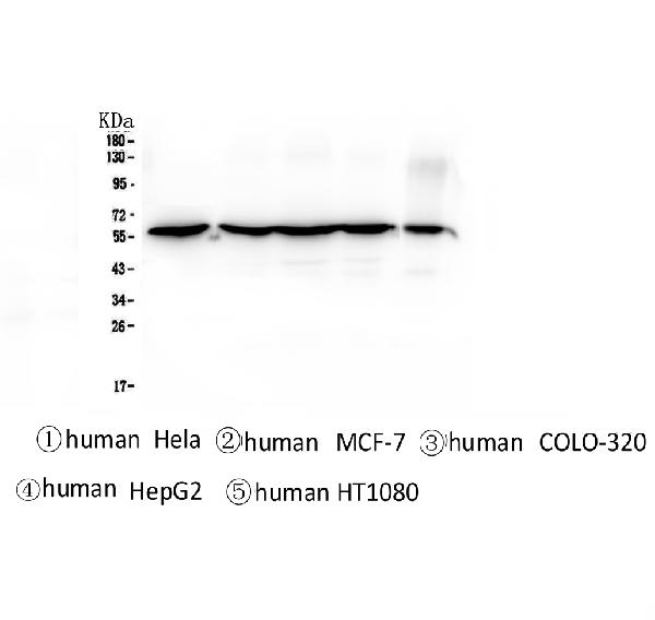 1 - Anti-CCT3 Antibody Picoband™ (monoclonal, 12H4) ABO14341