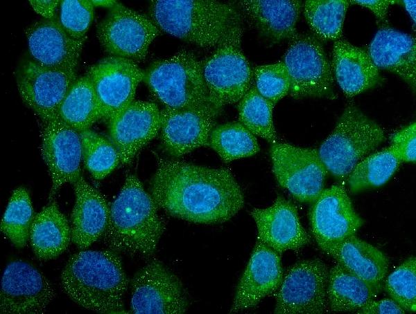 3 - Anti-CCT3 Antibody Picoband™ (monoclonal, 12H4) ABO14341
