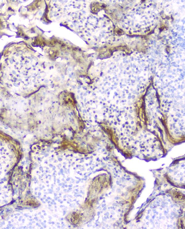 2 - Anti-Elafin/Skalp PI3 Antibody Picoband™ (monoclonal, C7) ABO14342