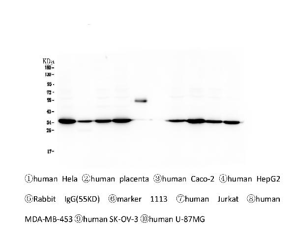 1 - Anti-Emerin EMD Antibody Picoband™ (monoclonal, 5A10) ABO14347