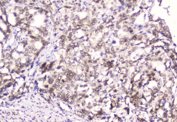 2 - Anti-Emerin EMD Antibody Picoband™ (monoclonal, 5A10) ABO14347