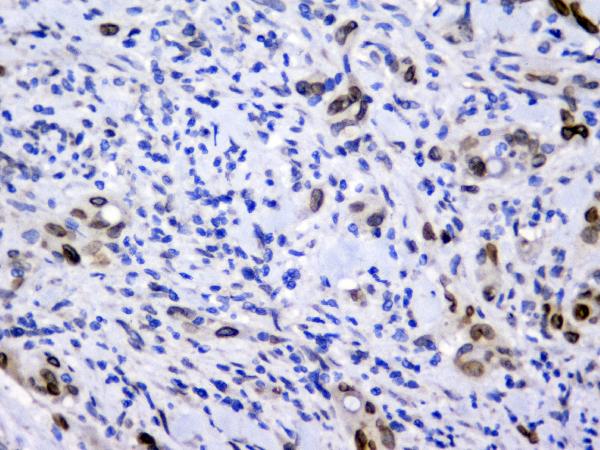 2 - Anti-Emerin EMD Antibody Picoband™ (monoclonal, 5A10) ABO14347