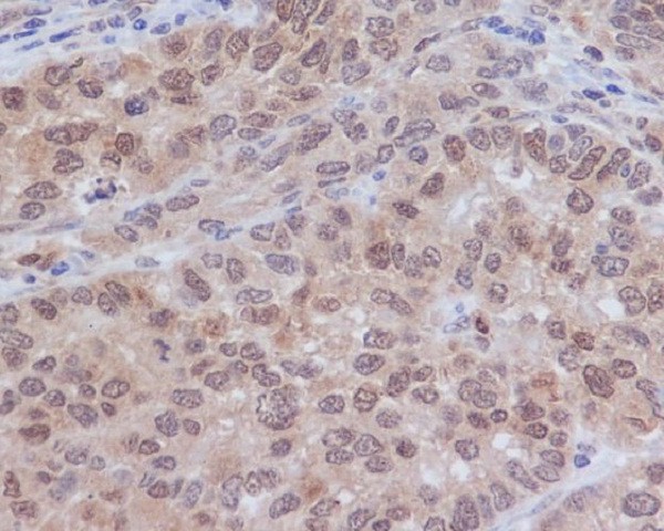 2 - Anti-ERK2 Monoclonal Antibody ABO14349