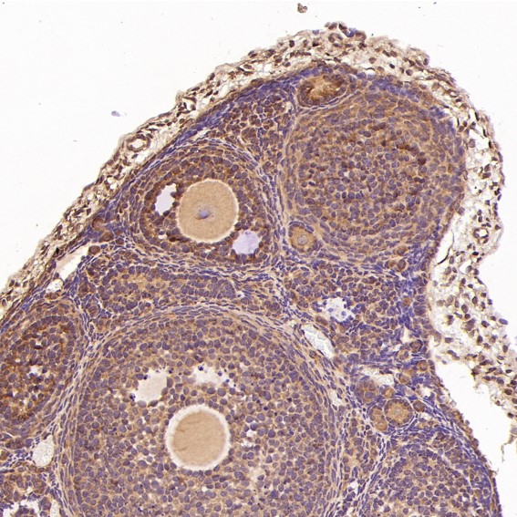2 - Anti-ERK2 Monoclonal Antibody ABO14349