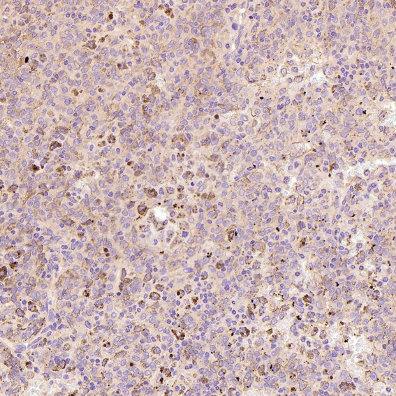 2 - Anti-ERK2 Monoclonal Antibody ABO14349