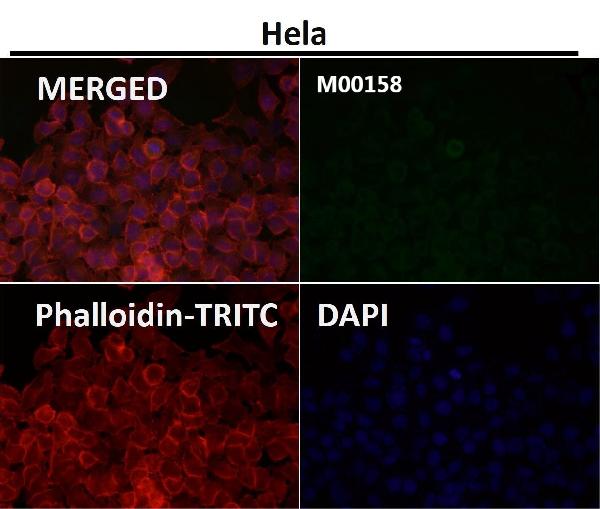 1 - Anti-CCR2/CKR2 Rabbit Monoclonal Antibody ABO14350