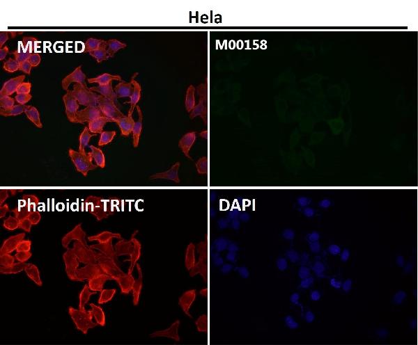 1 - Anti-CCR2/CKR2 Rabbit Monoclonal Antibody ABO14350