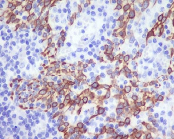 2 - Anti-CCR2/CKR2 Rabbit Monoclonal Antibody ABO14350