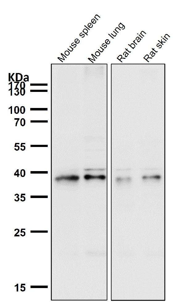 1 - Anti-CCR2/CKR2 Rabbit Monoclonal Antibody ABO14350