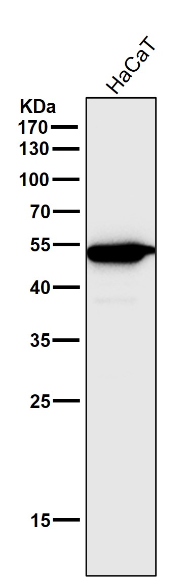 1 - Anti-CCR2/CKR2 Rabbit Monoclonal Antibody ABO14350