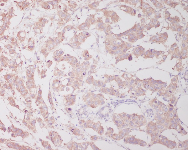 2 - Anti-Beclin 1 BECN1 Monoclonal Antibody ABO14351