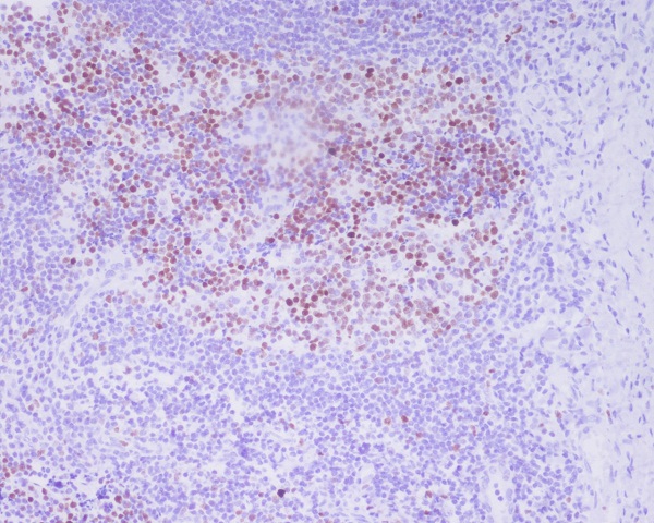 2 - Anti-Phospho-Histone H3 (T3) H3F3A Monoclonal Antibody ABO14352