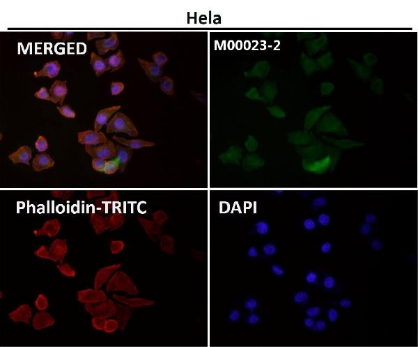 1 - Anti-EGFR (ErbB 1) Monoclonal Antibody ABO14353