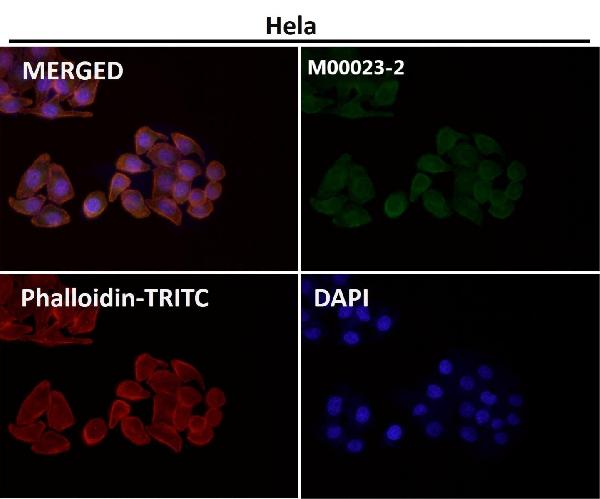 1 - Anti-EGFR (ErbB 1) Monoclonal Antibody ABO14353
