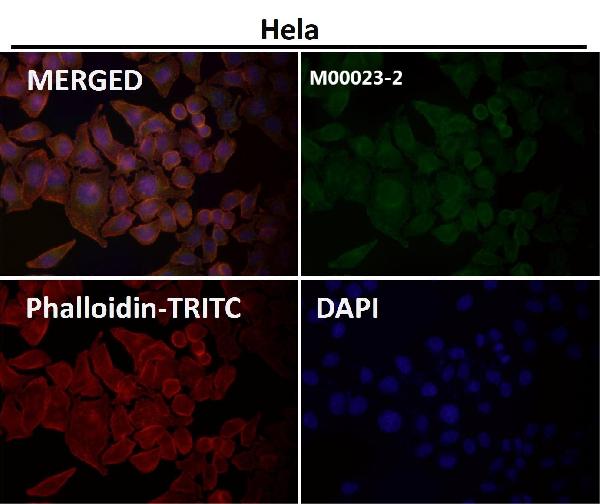1 - Anti-EGFR (ErbB 1) Monoclonal Antibody ABO14353