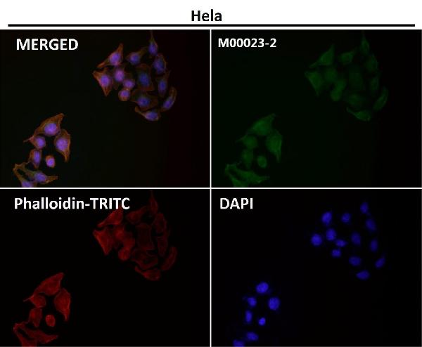 1 - Anti-EGFR (ErbB 1) Monoclonal Antibody ABO14353