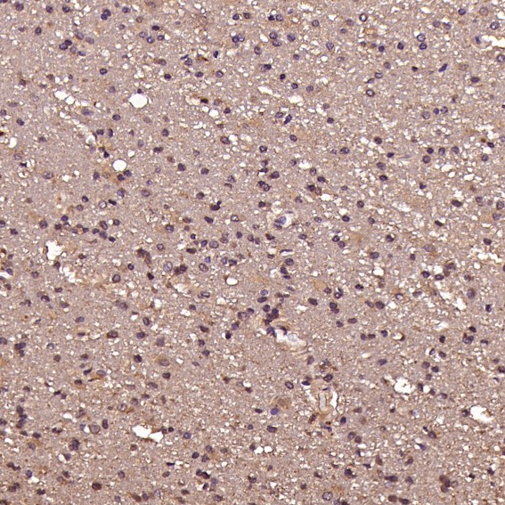 2 - Anti-EGFR (ErbB 1) Monoclonal Antibody ABO14353