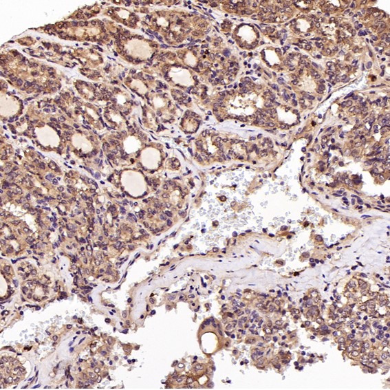 2 - Anti-EGFR (ErbB 1) Monoclonal Antibody ABO14353