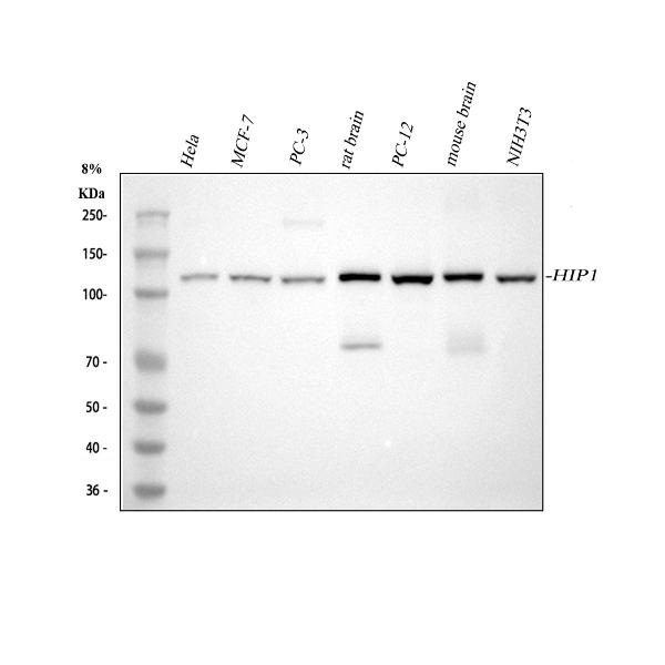 1 - Anti-HIP1 Monoclonal Antibody ABO14354