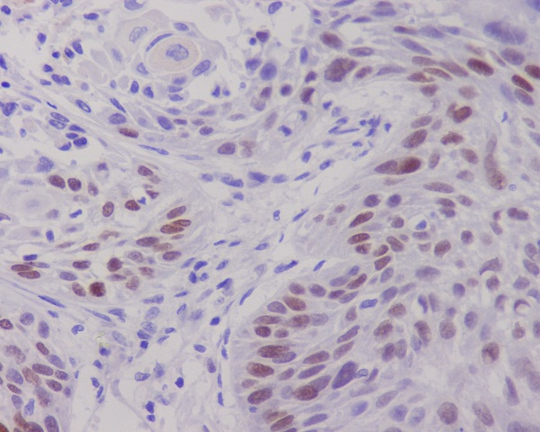 2 - Anti-c-Myc Monoclonal Antibody ABO14355