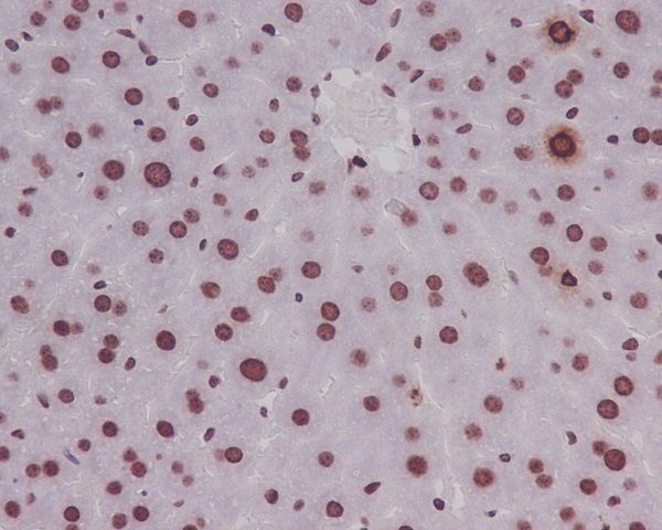2 - Anti-Phospho-Histone H3 (S10) HIST1H3A Rabbit Monoclonal Antibody ABO14356